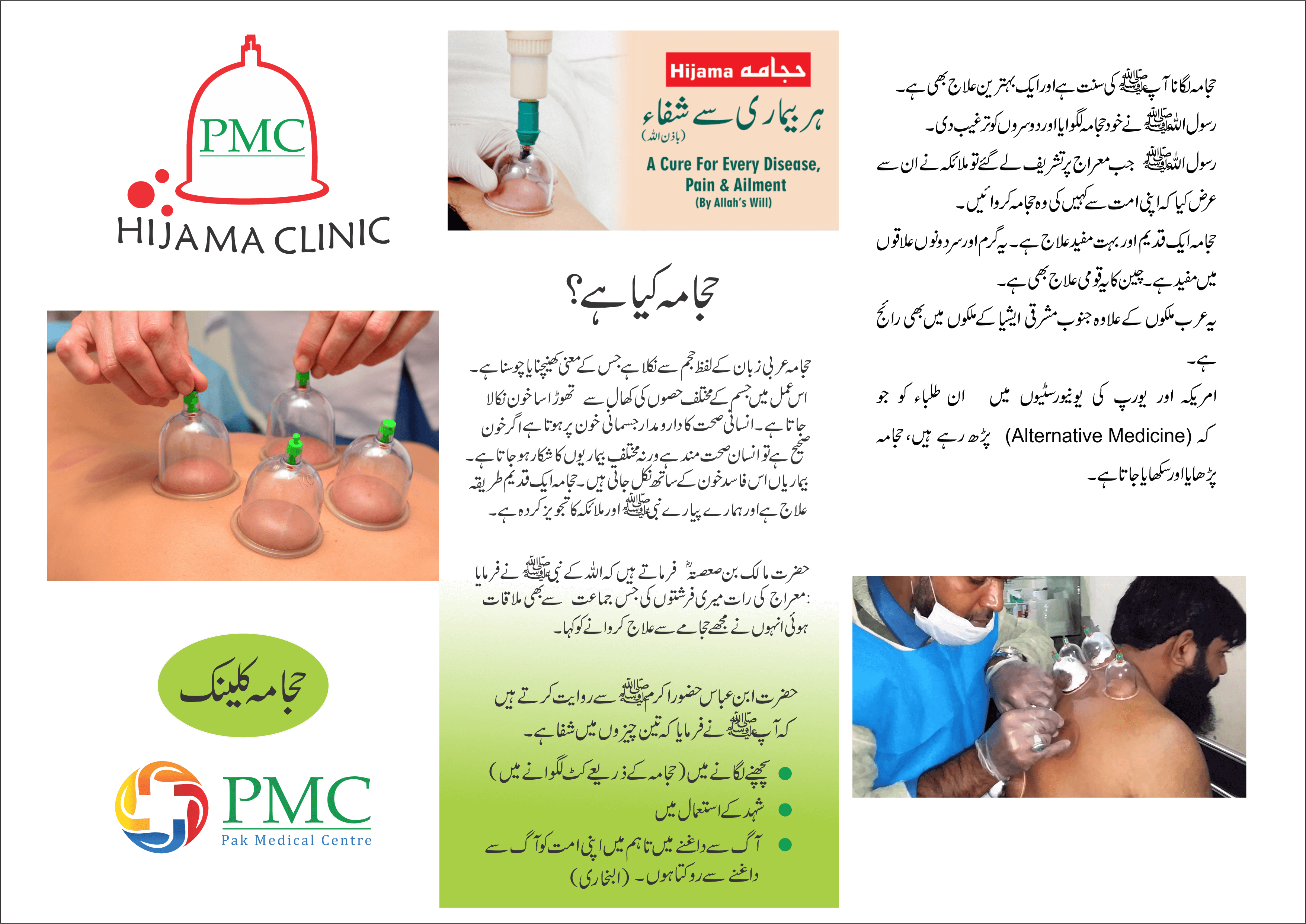 Hijama – Pak Medical Centre – Non-Profit Healthcare